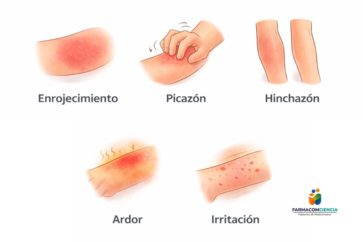 Efectos de los corticoides en la piel